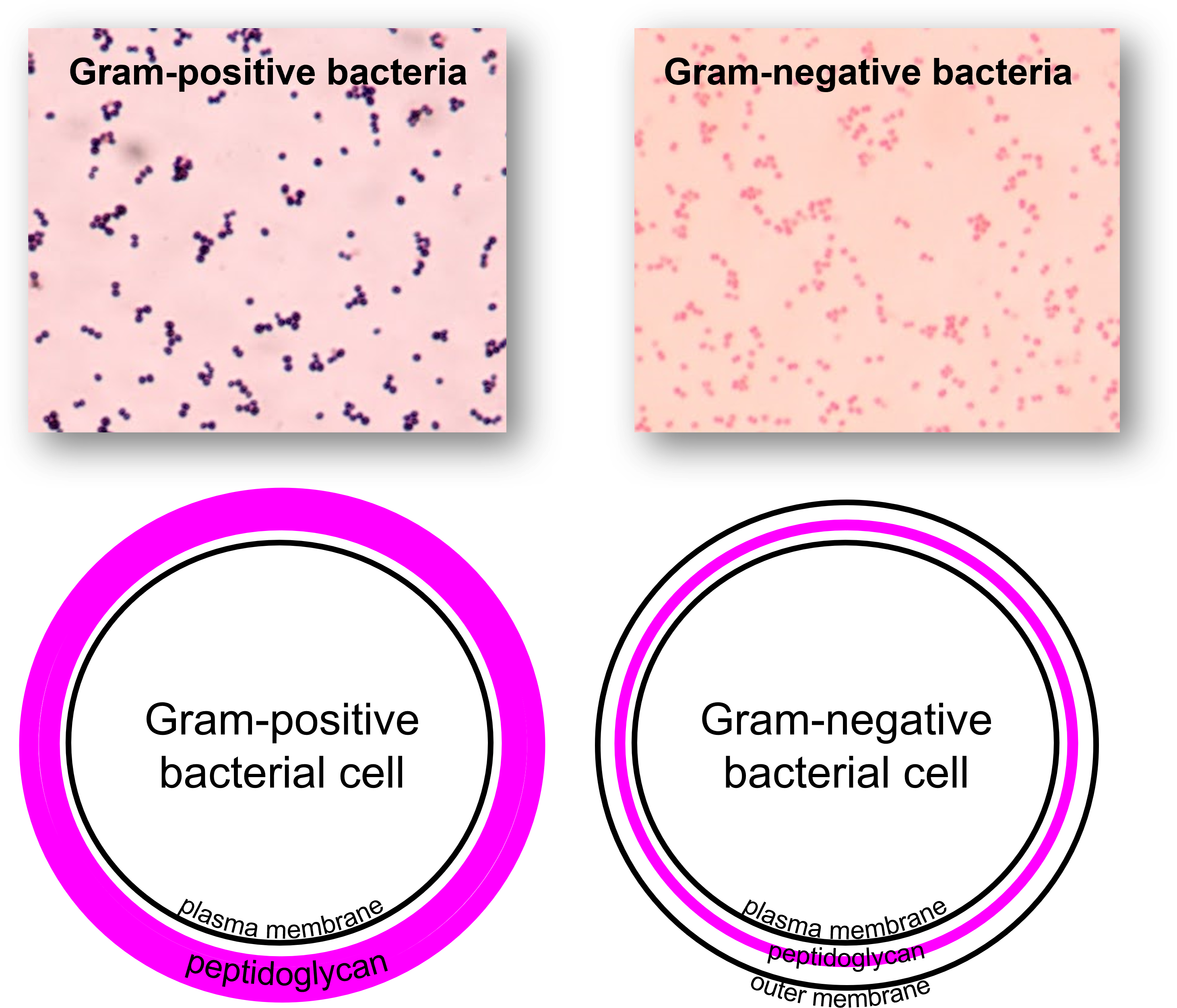 Gram negative vs gram positive bacteria